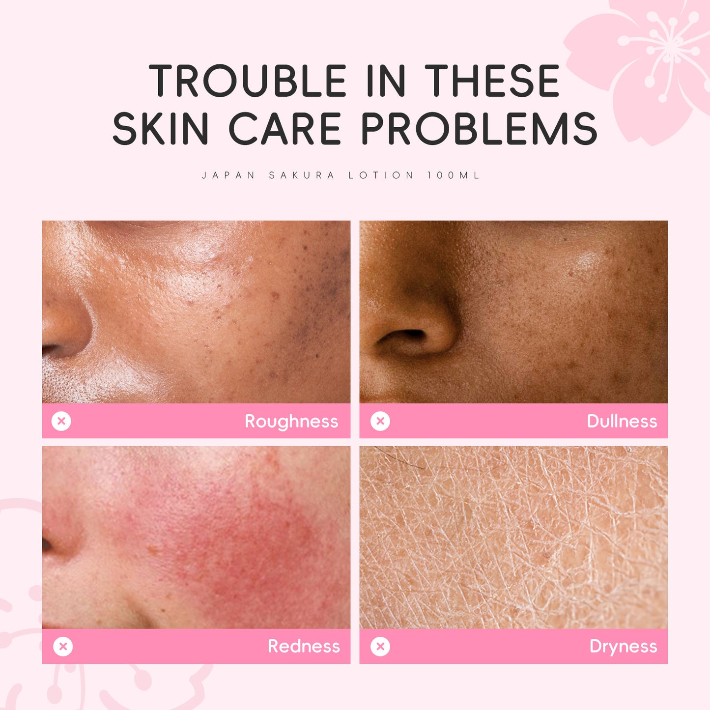 DR Japan Sakura Lotion